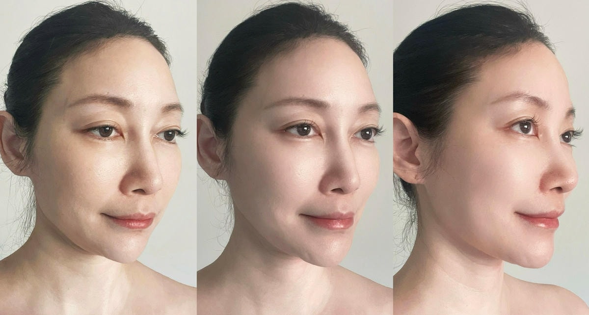 第三代海芙音波拉提 七種深度 完美緊緻拉提眼周頸紋雙下巴嘴 第三代海芙音波拉提 七種深度 完美緊緻拉提眼周頸紋雙下巴嘴