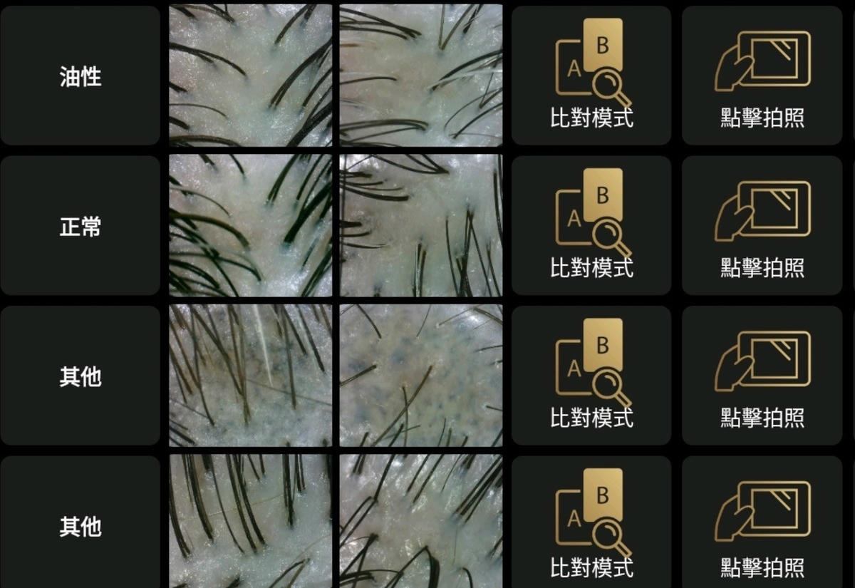 夏季頭皮油悶好不舒服? 台北頭皮SPA EDNA頭皮蘊養中心