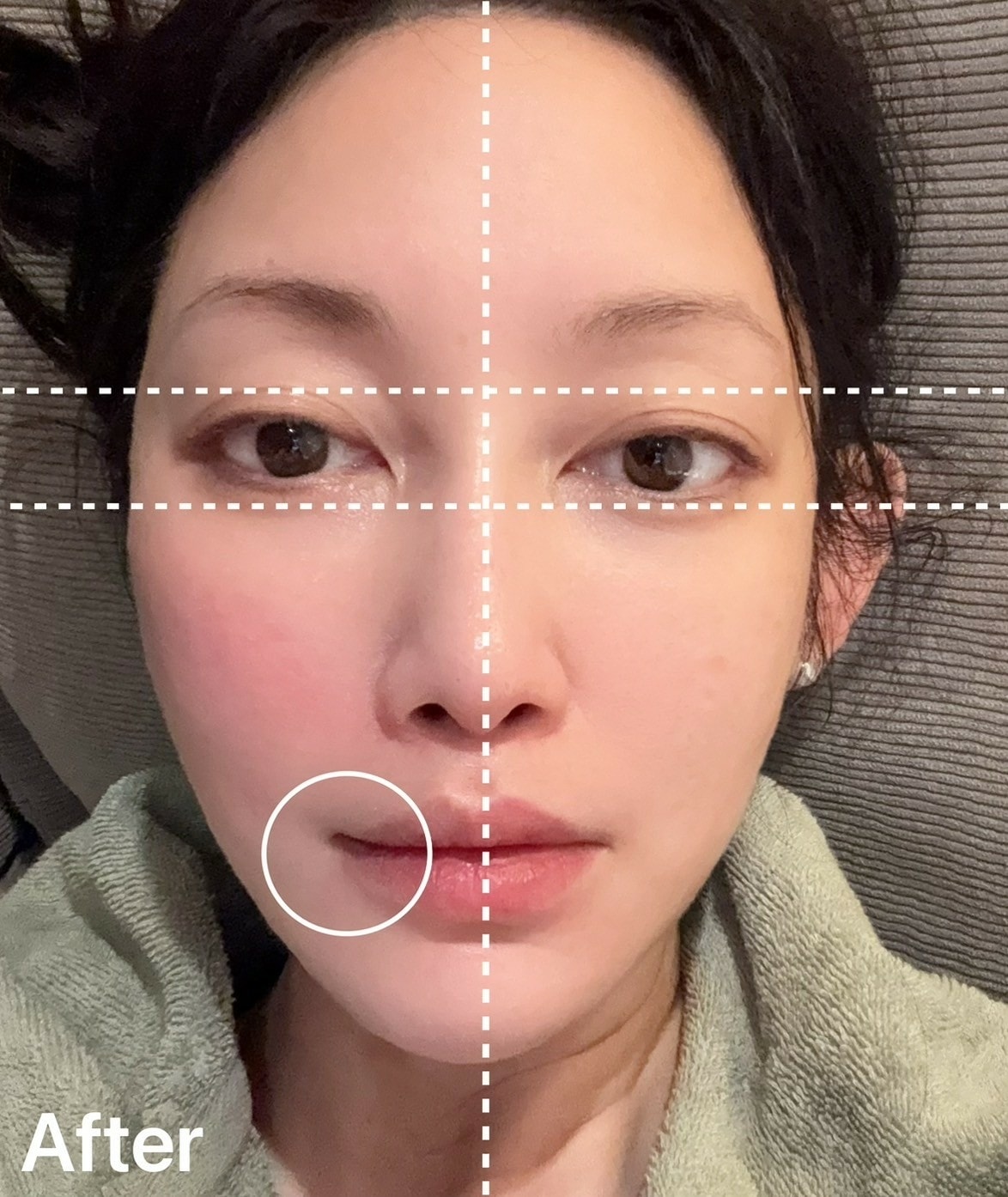 媲美醫美電音波的VoltaTM繃繃棒 6D超微電溫感緊緻儀,每 媲美醫美電音波的VoltaTM繃繃棒 6D超微電溫感緊緻儀,每