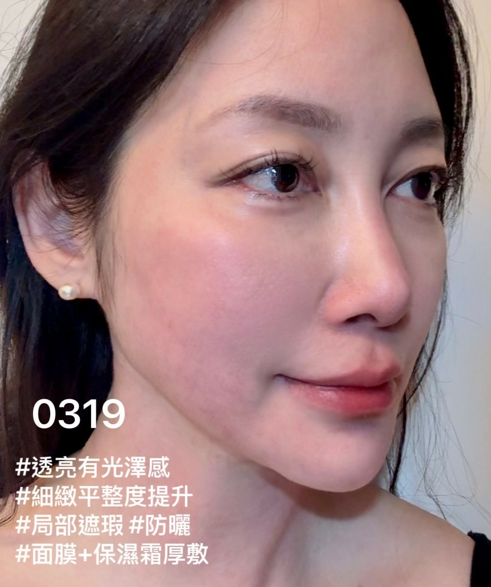 安妞美學診所天母店 精靈水光(閃電微針+精靈真肌(聚雙旋乳酸 安妞美學診所天母店 精靈水光(閃電微針+精靈真肌(聚雙旋乳酸